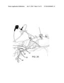 POSITIONAL STABILIZATION AND SECUREMENT COUPLING ATTACHMENT FOR USE IN     LAPAROSCOPIC SURGERY AND METHOD OF USE diagram and image