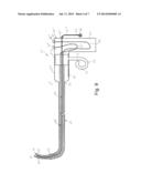 EXTENDABLE INTUBATION STYLET diagram and image