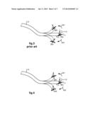 METHOD AND SYSTEM FOR AUTOMATICALLY MAINTAING AN OPERATOR SELECTED ROLL     ORIEINTATION AT A DISTAL TIP OF A ROBOTIC ENDOSCOPE diagram and image