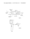 Otoscanner With Fan And Ring Laser diagram and image