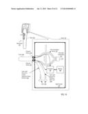 Otoscanner With Fan And Ring Laser diagram and image