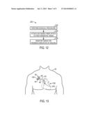 PHYSIOLOGICAL SENSOR HAVING BIODEGRADABLE OPTICS diagram and image