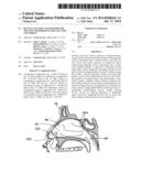 DEVICES, SYSTEMS AND METHODS FOR TREATING DISORDERS OF THE EAR, NOSE AND     THROAT diagram and image