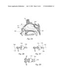 DEVICES, SYSTEMS AND METHODS FOR TREATING DISORDERS OF THE EAR, NOSE AND     THROAT diagram and image