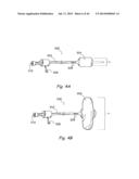 DEVICES, SYSTEMS AND METHODS FOR TREATING DISORDERS OF THE EAR, NOSE AND     THROAT diagram and image