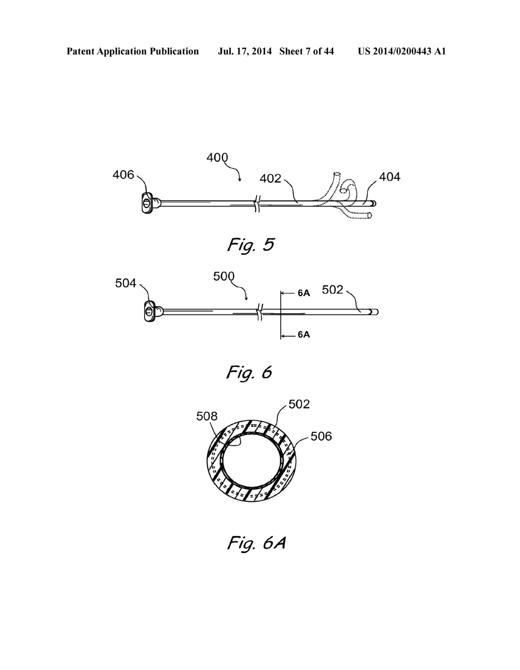 DEVICES, SYSTEMS AND METHODS FOR TREATING DISORDERS OF THE EAR, NOSE AND     THROAT - diagram, schematic, and image 08