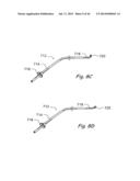 DEVICES, SYSTEMS AND METHODS FOR TREATING DISORDERS OF THE EAR, NOSE AND     THROAT diagram and image