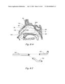 DEVICES, SYSTEMS AND METHODS FOR TREATING DISORDERS OF THE EAR, NOSE AND     THROAT diagram and image