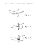 DEVICES, SYSTEMS AND METHODS FOR TREATING DISORDERS OF THE EAR, NOSE AND     THROAT diagram and image