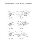 DEVICES, SYSTEMS AND METHODS FOR TREATING DISORDERS OF THE EAR, NOSE AND     THROAT diagram and image