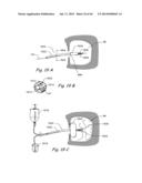 DEVICES, SYSTEMS AND METHODS FOR TREATING DISORDERS OF THE EAR, NOSE AND     THROAT diagram and image