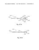 DEVICES, SYSTEMS AND METHODS FOR TREATING DISORDERS OF THE EAR, NOSE AND     THROAT diagram and image