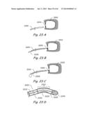 DEVICES, SYSTEMS AND METHODS FOR TREATING DISORDERS OF THE EAR, NOSE AND     THROAT diagram and image