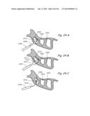 DEVICES, SYSTEMS AND METHODS FOR TREATING DISORDERS OF THE EAR, NOSE AND     THROAT diagram and image