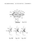 DEVICES, SYSTEMS AND METHODS FOR TREATING DISORDERS OF THE EAR, NOSE AND     THROAT diagram and image