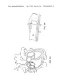 METHODS AND SYSTEMS FOR DETERMINING SPATIOTEMPORAL VARIABILITY FOR MAPPING     CARDIAC FIBRILLATION diagram and image