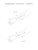 MEDICAL MARKING APPARATUS AND METHOD OF USE diagram and image