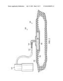 MANUALLY-ACTUATED REDUCED PRESSURE TREATMENT SYSTEM WITH AUDIBLE LEAK     INDICATOR diagram and image