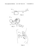 Systems and Methods for Neuromodulation for Treatment of Pain and Other     Disorders Associated with Nerve Conduction diagram and image