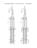 PLUNGER TIP COUPLING DEVICE FOR INTRAOCULAR LENS INJECTOR diagram and image