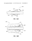 CERVICAL SEALING APPARATUS diagram and image