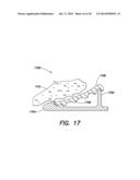 CERVICAL SEALING APPARATUS diagram and image