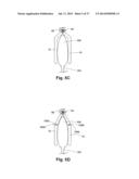 DEVICES AND SYSTEMS CONFIGURED TO FIT AROUND A TISSUE OR ORGAN AND METHODS     OF USING THE SAME diagram and image