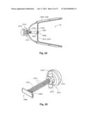 DEVICES AND SYSTEMS CONFIGURED TO FIT AROUND A TISSUE OR ORGAN AND METHODS     OF USING THE SAME diagram and image