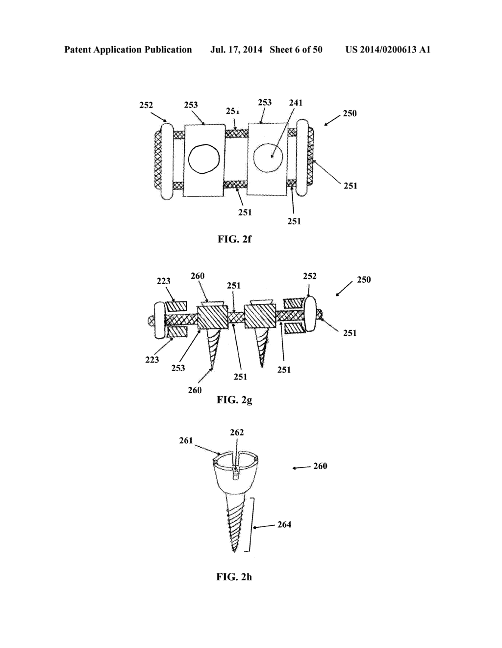 DYNAMIC SPINAL PLATING SYSTEM - diagram, schematic, and image 07