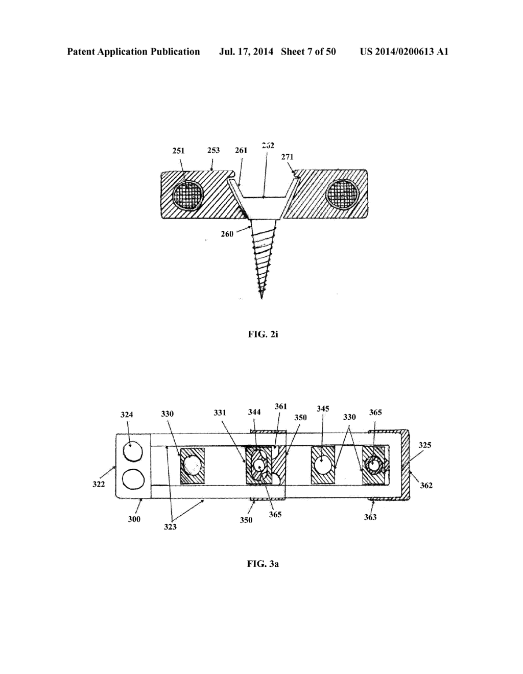 DYNAMIC SPINAL PLATING SYSTEM - diagram, schematic, and image 08