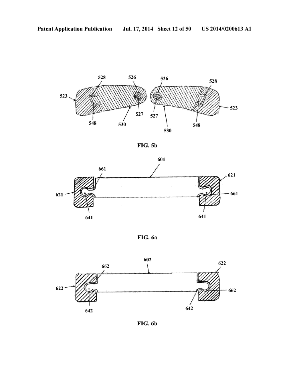 DYNAMIC SPINAL PLATING SYSTEM - diagram, schematic, and image 13