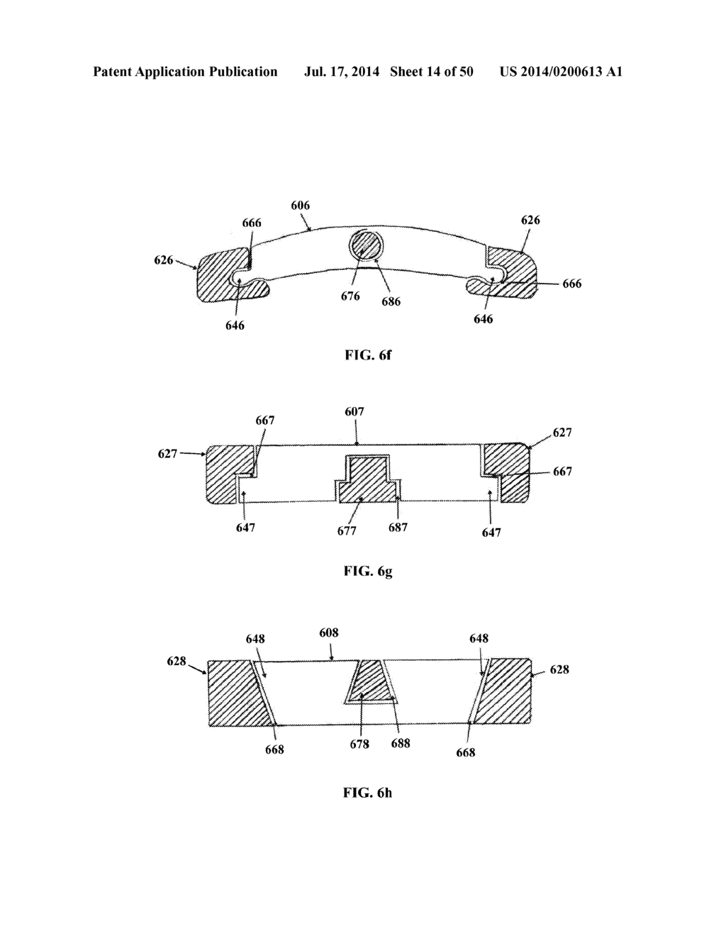 DYNAMIC SPINAL PLATING SYSTEM - diagram, schematic, and image 15