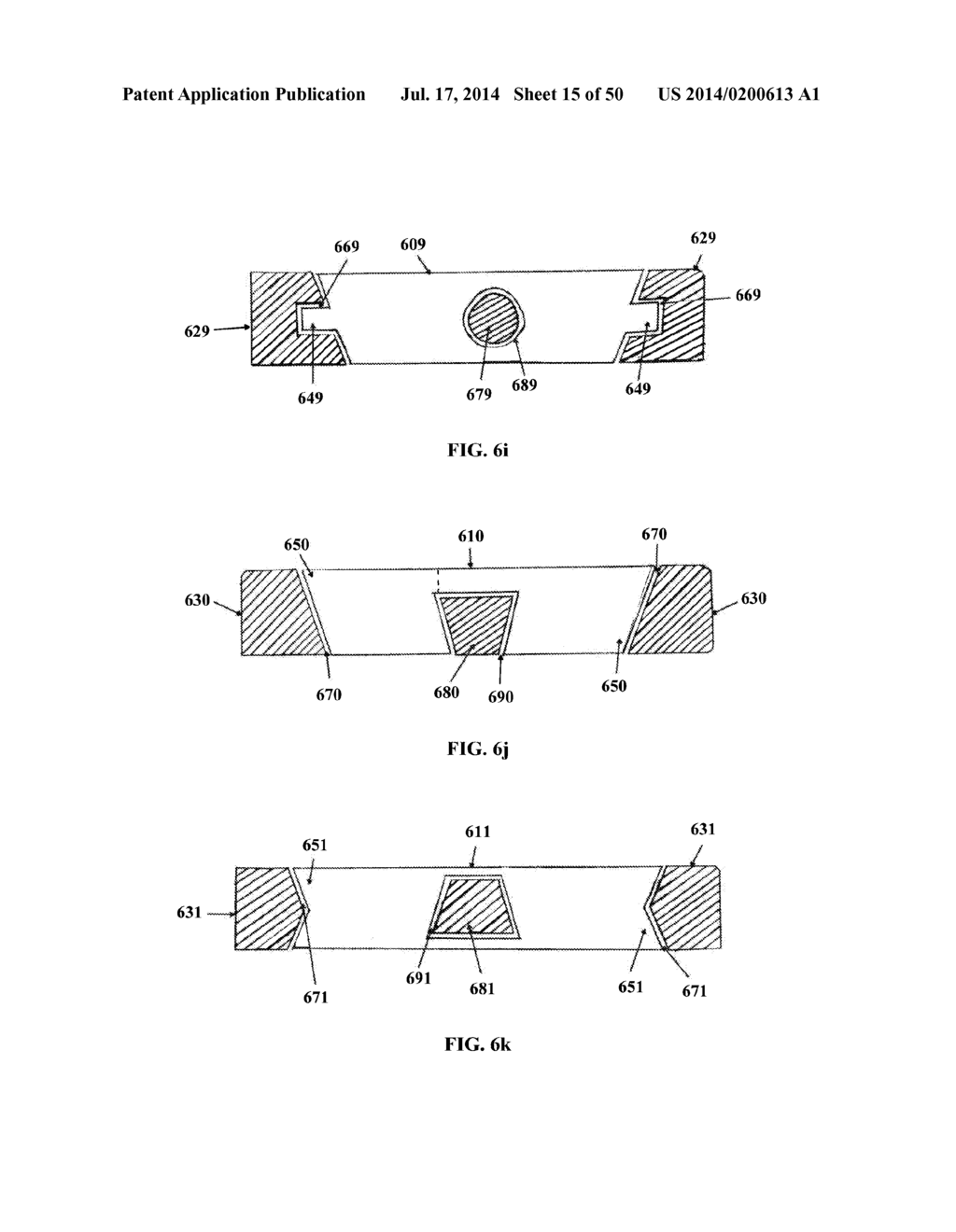 DYNAMIC SPINAL PLATING SYSTEM - diagram, schematic, and image 16