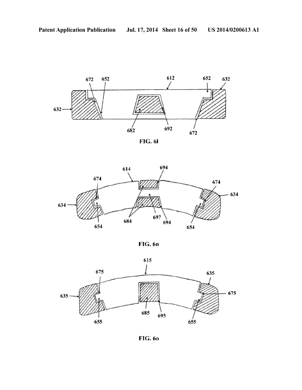 DYNAMIC SPINAL PLATING SYSTEM - diagram, schematic, and image 17