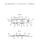 DYNAMIC SPINAL PLATING SYSTEM diagram and image