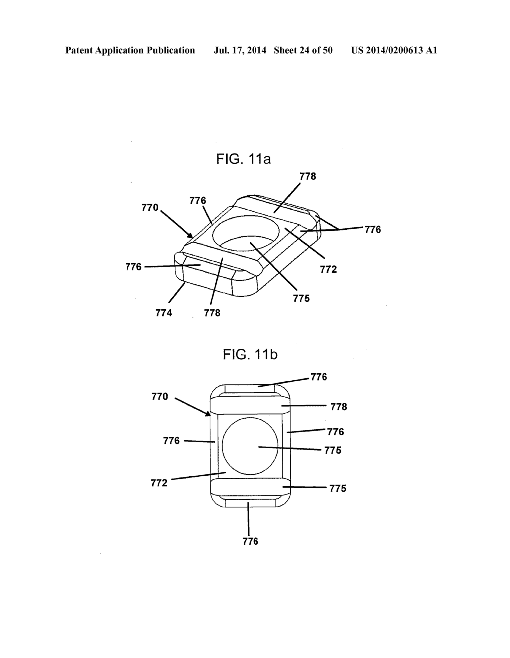 DYNAMIC SPINAL PLATING SYSTEM - diagram, schematic, and image 25