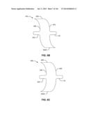 SYSTEMS AND METHODS FOR FUSING A SACROILIAC JOINT AND ANCHORING AN     ORTHOPEDIC APPLIANCE diagram and image