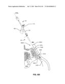 SYSTEMS AND METHODS FOR FUSING A SACROILIAC JOINT AND ANCHORING AN     ORTHOPEDIC APPLIANCE diagram and image