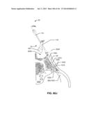 SYSTEMS AND METHODS FOR FUSING A SACROILIAC JOINT AND ANCHORING AN     ORTHOPEDIC APPLIANCE diagram and image