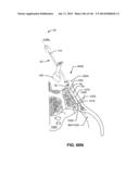 SYSTEMS AND METHODS FOR FUSING A SACROILIAC JOINT AND ANCHORING AN     ORTHOPEDIC APPLIANCE diagram and image