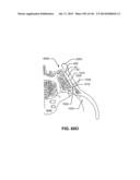 SYSTEMS AND METHODS FOR FUSING A SACROILIAC JOINT AND ANCHORING AN     ORTHOPEDIC APPLIANCE diagram and image