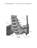 SYSTEMS AND METHODS FOR FUSING A SACROILIAC JOINT AND ANCHORING AN     ORTHOPEDIC APPLIANCE diagram and image