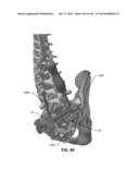 SYSTEMS AND METHODS FOR FUSING A SACROILIAC JOINT AND ANCHORING AN     ORTHOPEDIC APPLIANCE diagram and image