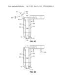 SYSTEMS AND METHODS FOR FUSING A SACROILIAC JOINT AND ANCHORING AN     ORTHOPEDIC APPLIANCE diagram and image