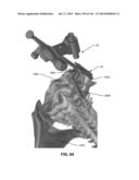 SYSTEMS AND METHODS FOR FUSING A SACROILIAC JOINT AND ANCHORING AN     ORTHOPEDIC APPLIANCE diagram and image