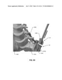 SYSTEMS AND METHODS FOR FUSING A SACROILIAC JOINT AND ANCHORING AN     ORTHOPEDIC APPLIANCE diagram and image