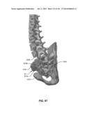 SYSTEMS AND METHODS FOR FUSING A SACROILIAC JOINT AND ANCHORING AN     ORTHOPEDIC APPLIANCE diagram and image