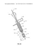 SYSTEMS AND METHODS FOR FUSING A SACROILIAC JOINT AND ANCHORING AN     ORTHOPEDIC APPLIANCE diagram and image