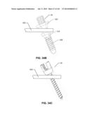 SYSTEMS AND METHODS FOR FUSING A SACROILIAC JOINT AND ANCHORING AN     ORTHOPEDIC APPLIANCE diagram and image