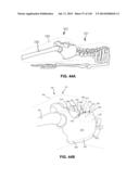 SYSTEMS AND METHODS FOR FUSING A SACROILIAC JOINT AND ANCHORING AN     ORTHOPEDIC APPLIANCE diagram and image